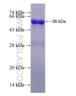 Recombinant human CSTF1 protein Ag0109 proteintech