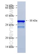 Recombinant human SAA1 protein Ag10160 proteintech