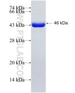 Recombinant human RAB11FIP1 protein Ag10309 proteintech