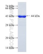 Recombinant human GPT2 protein Ag10360 proteintech