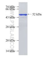 Recombinant human PRX3 protein Ag1062 proteintech
