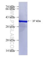 Recombinant human CST6 protein Ag10965 proteintech