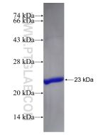 Recombinant human RTKN2 protein Ag11098 proteintech