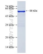 Recombinant human PPT1 protein Ag1131 proteintech