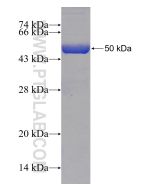 Recombinant human CMBL protein Ag11442 proteintech