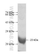 Recombinant human SLC6A18 protein Ag11685 proteintech
