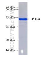 Recombinant human THAP10 protein Ag12541 proteintech