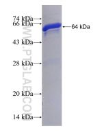 Recombinant human PTPN14 protein Ag12571 proteintech