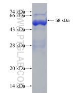 Recombinant human CD248 protein Ag13334 proteintech