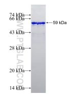 Recombinant human GAL3ST1 protein Ag13353 proteintech