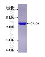 Recombinant human TTPA protein Ag13587 proteintech