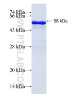 Recombinant human NCOA5 protein Ag14014 proteintech