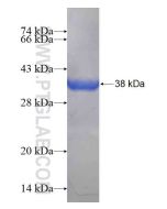 Recombinant human PIP4K2B protein Ag14467 proteintech