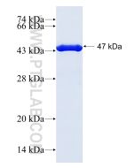 Recombinant human HPCA protein Ag1449 proteintech