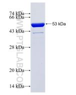 Recombinant human LZTS1 protein Ag14977 proteintech