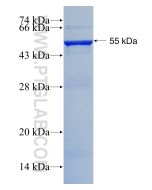 Recombinant human PSMB4 protein Ag1500 proteintech