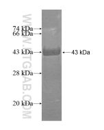 Recombinant human STARD13 protein Ag15093 proteintech