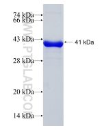 Recombinant human FGD5 protein Ag15446 proteintech