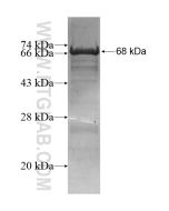Recombinant human ZNF276 protein Ag15479 proteintech