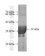 Recombinant human Mammaglobin protein Ag15609 proteintech