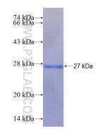 Recombinant human TMX3 protein Ag15622 proteintech