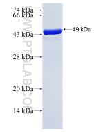 Recombinant human HAPLN4 protein Ag15687 proteintech
