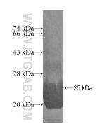 Recombinant human KCTD11 protein Ag15973 proteintech