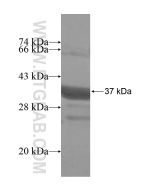 Recombinant human TLL2 protein Ag16209 proteintech