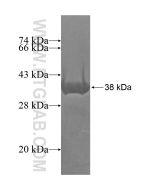 Recombinant human OCM protein Ag16358 proteintech