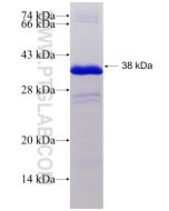 Recombinant human NELL1 protein Ag16542 proteintech