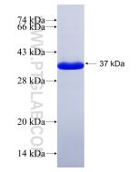 Recombinant human KEAP1 protein Ag16693 proteintech