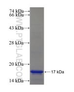 Recombinant human ZDHHC15 protein Ag16740 proteintech