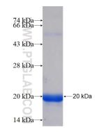 Recombinant human SOAT2 protein Ag16757 proteintech