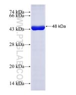 Recombinant human PIGR protein Ag16876 proteintech