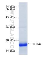 Recombinant human SLC1A3 protein Ag16962 proteintech