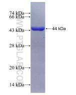 Recombinant human IMPDH2 protein Ag17170 proteintech