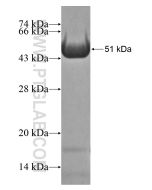 Recombinant human ARHGAP27 protein Ag17225 proteintech