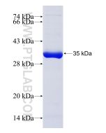 Recombinant human BCDIN3D protein Ag17249 proteintech
