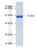 Recombinant human AR protein Ag17291 proteintech