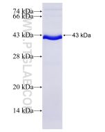 Recombinant human Integrin beta-4 protein Ag17395 proteintech
