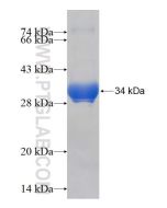 Recombinant human MAGEC2 protein Ag17423 proteintech