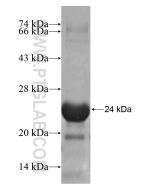 Recombinant human KCNH1 protein Ag17430 proteintech