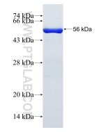 Recombinant human TIGAR protein Ag17532 proteintech