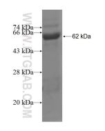 Recombinant human AASDHPPT protein Ag1763 proteintech