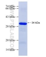 Recombinant human NOS2 protein Ag17696 proteintech