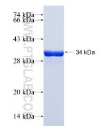 Recombinant human STK4 protein Ag17738 proteintech
