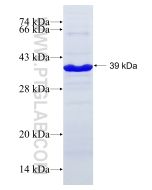 Recombinant human RBM15 protein Ag17970 proteintech