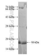 Recombinant human BEX5 protein Ag17979 proteintech