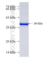 Recombinant human NPSR1 protein Ag18785 proteintech