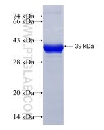 Recombinant human ADARB2 protein Ag18828 proteintech